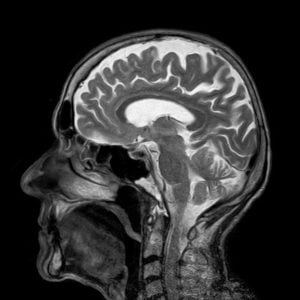 Rezonans magnetyczny głowy